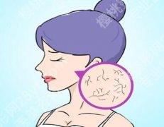 如何面部红血丝？2种有效方法对比，敏感肌快速