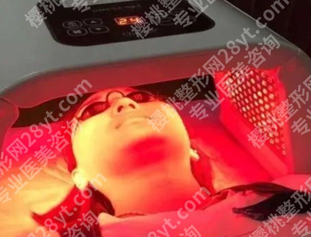 红蓝光祛痘到底有没有效果？灯一打，痘就跑？科学告诉你真相