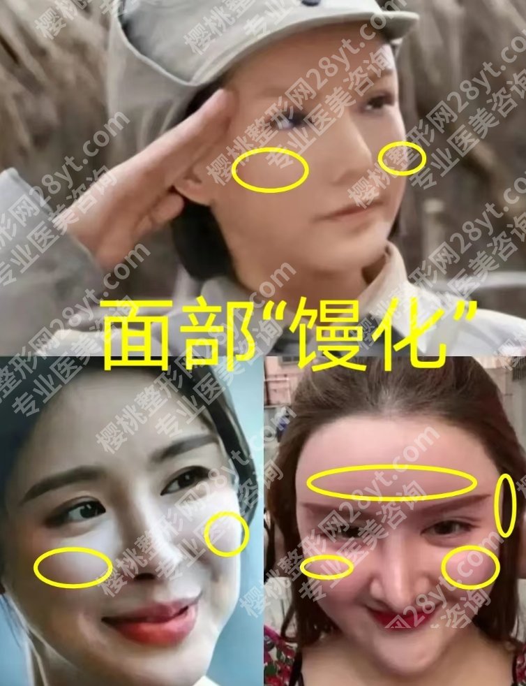 馒化脸做热玛吉还是超声炮？别再盲目跟风，馒化脸修复有科学路径