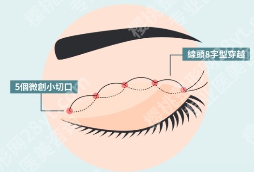 哈尔滨瑞丽做双眼皮好的医生，本地求美者口碑推荐：哪些医生值得信赖