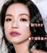 阔面脸是什么脸型？明星脸型对照：谁是典型代表？