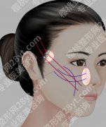 重庆颧骨整形医院排名，价格、技术、恢复期全揭秘，到底选择谁？