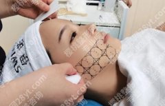 热拉提多久做一次,一疗程几次？“打工脸”逆袭“贵妇脸”？全靠它节奏对！