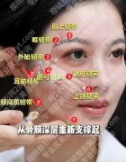 韧带提升的优缺点，到底是抗衰捷径还是智商税？