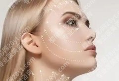 线雕面部提升能维持多久？和爱情一样，要看维不维护…