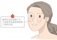 填苹果肌会不会显脸大？饱满感vs肿胀感，一线之差！