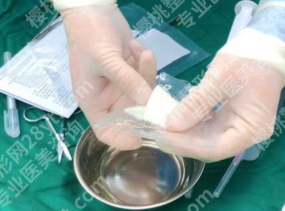 男性生物补片可以维持几年？到底有没有统一的标准｜真实情况别被忽悠