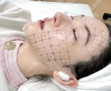 肉脸适合超声炮还是热玛吉，想脸部轮廓和松弛感，怎么选才更靠谱