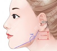 颧骨磨骨整形技术如何？颧骨操作过程曝光，详细看看