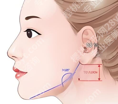 颧骨磨骨整形技术如何？颧骨操作过程曝光，详细看看