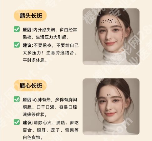 广州中山三院点阵激光怎么样？真人祛斑案例图反馈！