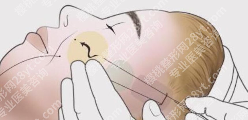 上海东方医院除皱怎么样？院内胡皓、卢璐、李宇飞等都是技术流！