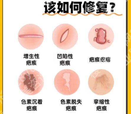 绍兴人民医院点阵激光价格表更新！医院基本资料介绍