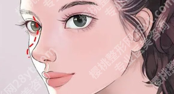 上海九院隆鼻哪个医生比较好？王琛、祝联、昝涛等都是实力大咖！