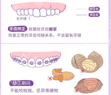 南方医科大学深圳医院正畸科怎么样？经典案例附上！效果|价格对比