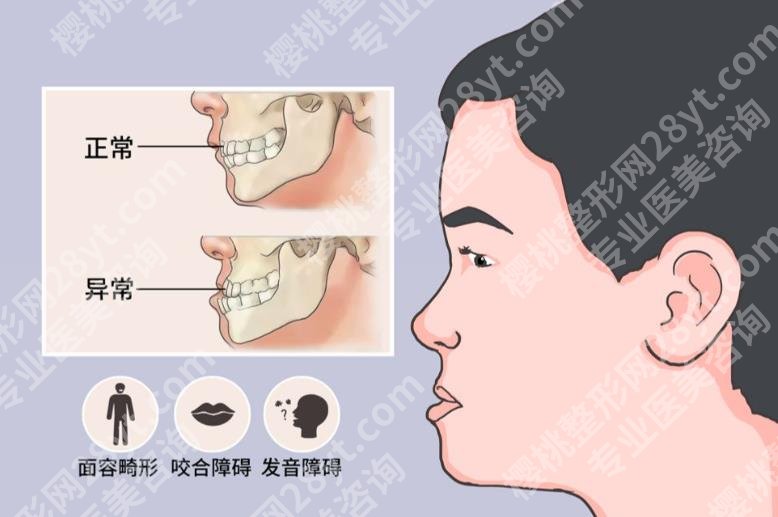 广东美恩周会喜正颌手术怎么样？技术/价格/案例/口碑1篇讲清楚！