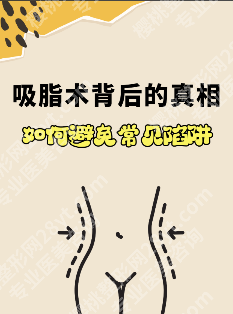 哈尔滨医大一院吸脂实测：设备/价格/案例全解析