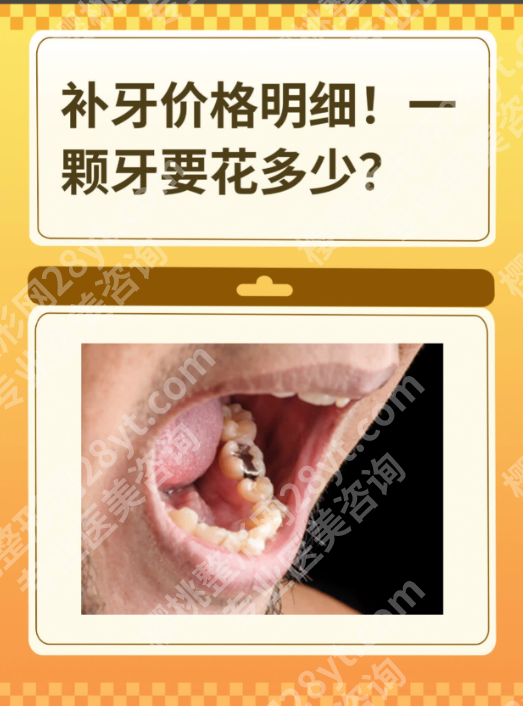 佛山南海人民医院牙科补牙要多少钱？新价格表+避坑指南，本地人都说值