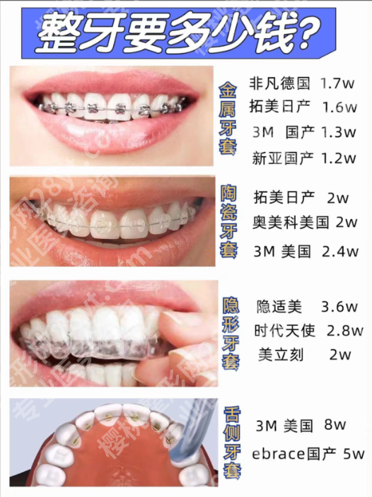 重医附一院矫正牙齿费用详解：从价格到优势，一篇帮你算清预算