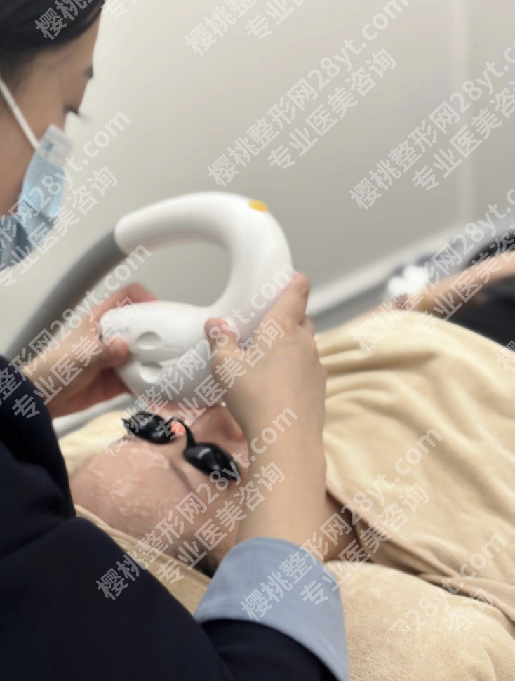 光子嫩肤做完后的注意事项：30天护理指南+避坑清单，医生不会说的7个真相