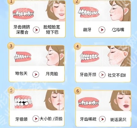 河北省二院正畸费用贵不贵？金属托槽矫正9k起~