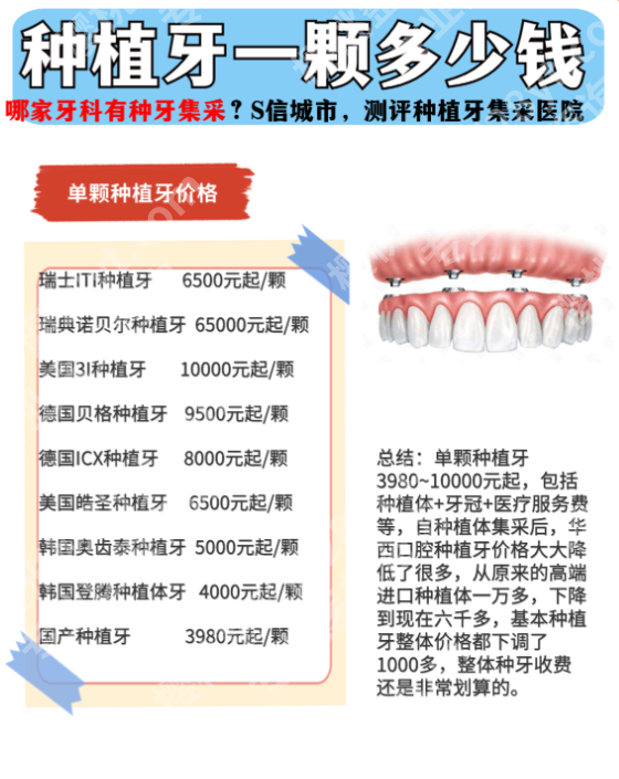 上海六院种植牙大概多少钱一颗啊？不同种植方案费用一览