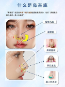 垫鼻基底的6个后遗症：常见问题+避坑指南，新手必看！