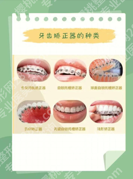 珠海人民医院牙齿矫正全攻略：告别歪牙，绽放自信笑容