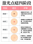 广州珠江医院美容科激光点痣好不好？2025真实案例+价格表，怕留疤的姐妹必看！