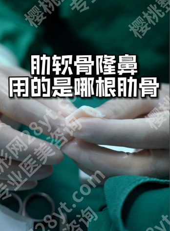 肋软骨隆鼻后肋骨一般多久恢复好？2025新恢复时间表，怕疼怕留疤的姐妹必看！