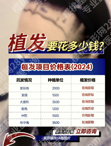 上海第九人民医院植发价格是多少？按“毛囊单位”收费！新价目表来了