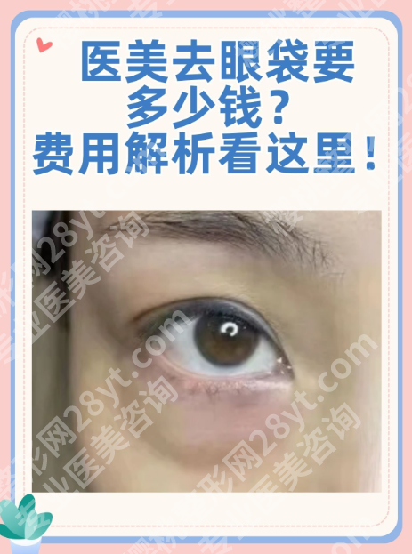 上海东方医院祛眼袋多少钱？不同眼袋类型、花费、效果公开了