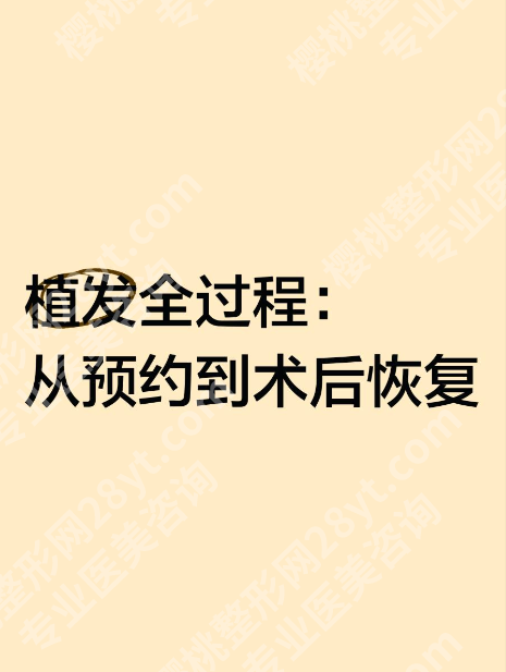 广州南方医院植发专科要怎么预约？3种预约方式+避坑指南，附真实案例！