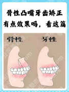 矫正骨性嘴凸要打骨钉吗？正畸医生不会明说的3种情况，看完不纠结！