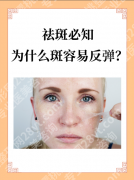 做祛斑会反弹吗？真相揭秘：不同斑型反弹率+防反弹攻略