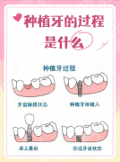 上海华东医院种植牙怎么样？2张数据表格，搞懂“种牙到底值不值”！