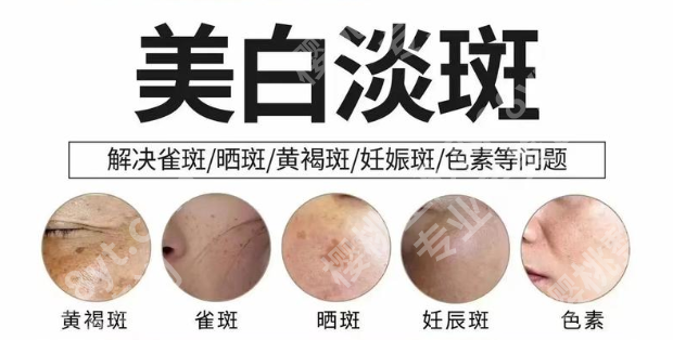 浙江省中医院祛斑效果怎么样？2张表格，扒透“疗效”和“疗程”