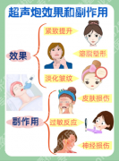 做超声炮有没有副作用？先分清“正常反应”和“异常风险”