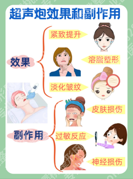 做超声炮有没有副作用？先分清“正常反应”和“异常风险”
