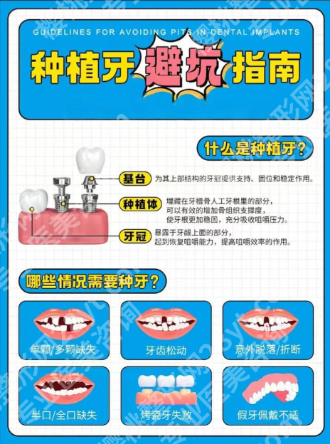 成都市第一人民医院种植牙齿价格大剖析，影响因素全知晓