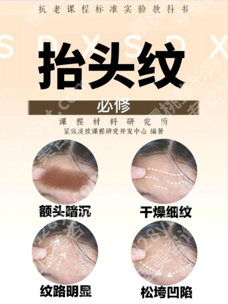 玻尿酸抬头纹做填充多久自然？从肿胀到恢复，全流程细节说透！