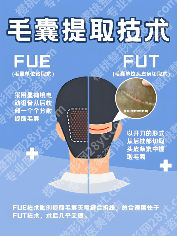 宜昌中心医院植发：技术创新，美学与功能双兼顾