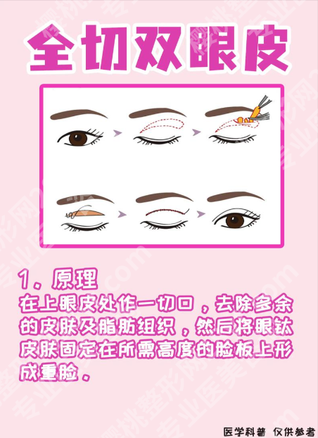 深圳市人民医院割双眼皮：这4个“隐藏优势”，比你刷100条测评还管用！