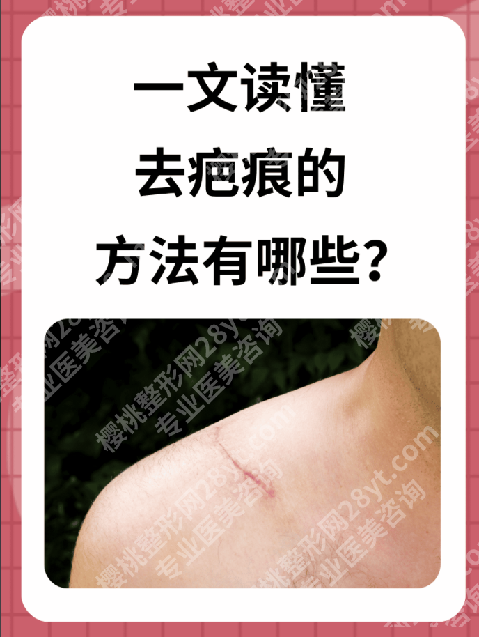 上海第六人民医院去疤痕专家推荐：2025技术对比+真实案例+挂号攻略