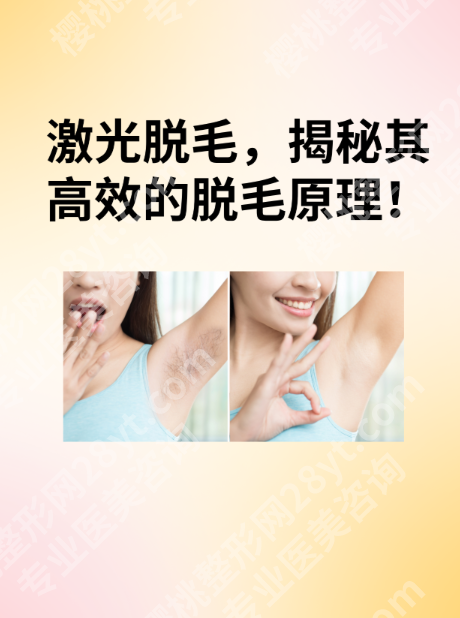 上海六院激光脱毛靠谱吗？价格、效果、避坑指南一次说清！