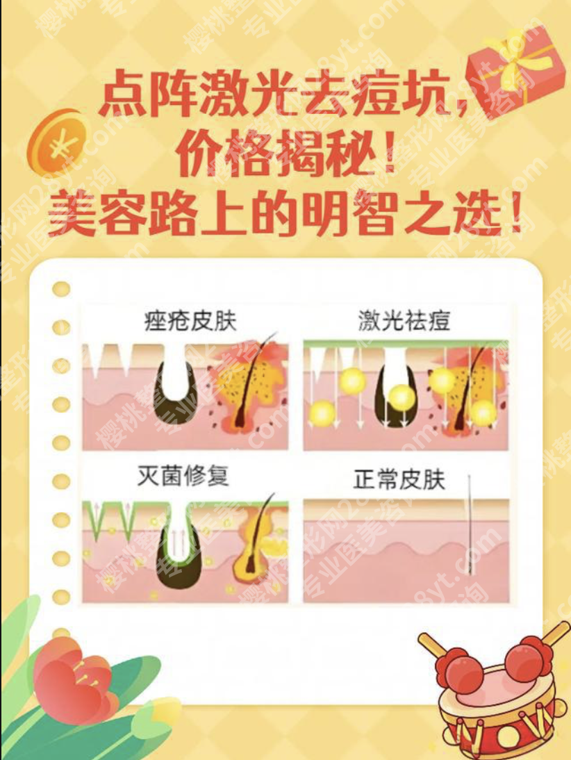 上海九院点阵激光价格：从1204到9088元，差价7倍的真相揭秘