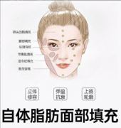 金华中心医院脂肪填充价格：项目解析，看看怎么算