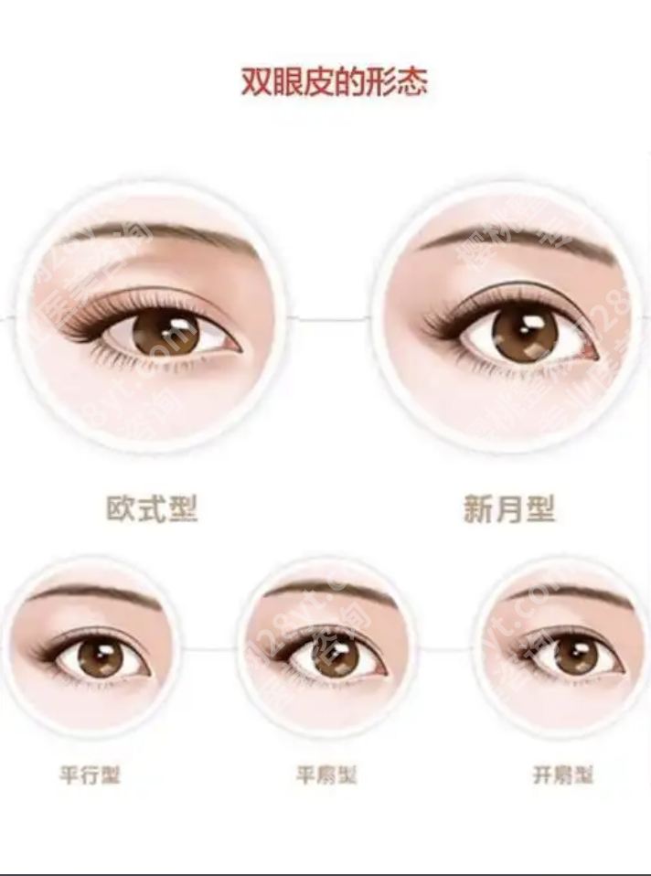 上海六院割双眼皮费用：揭开费用差异背后的真相