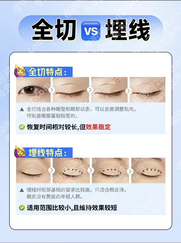 定点双眼皮和埋线的区别：3分钟搞懂怎么选，附真实案例与避坑指南