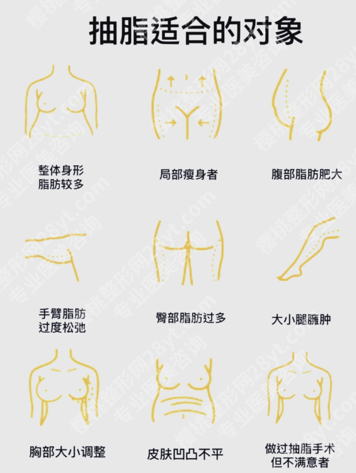 合肥大腿吸脂比较好的医院：2张表帮你快速对比选医院